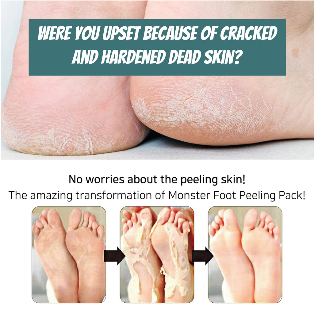 Monster Foot Peeling Pack 1pc-MayDay Mall
