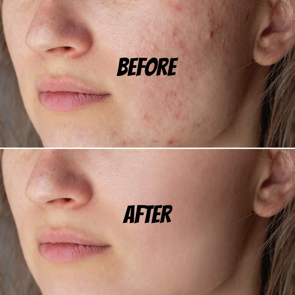 Sparkling Bubble Mask Pack 1 pc-MayDay Mall