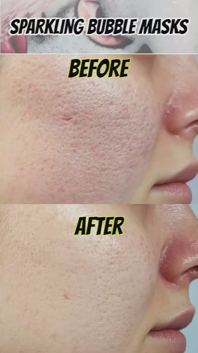 Sparkling Bubble Mask Pack 1 pc Korean Skincare-MayDay Mall